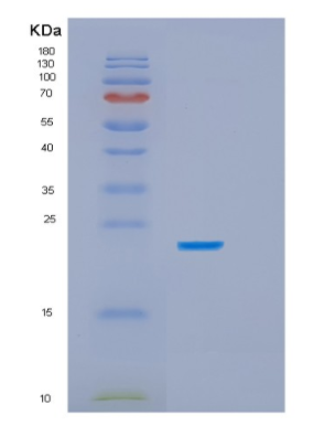 Recombinant Human HSPB8/HSP22 Protein