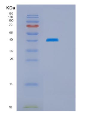 Recombinant Human HSPBP1 Protein
