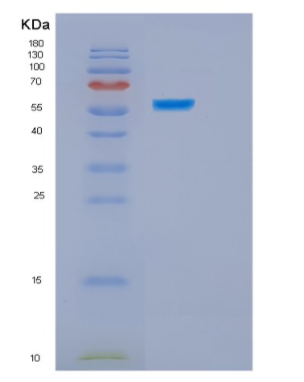 Recombinant Human HSPBAP1 Protein