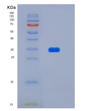 Recombinant Human HtrA2/Omi 134-458 Human Protein