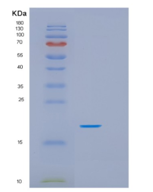 Recombinant Human HSPB7 Protein