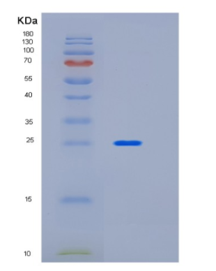 Recombinant Human ICAM2 Protein