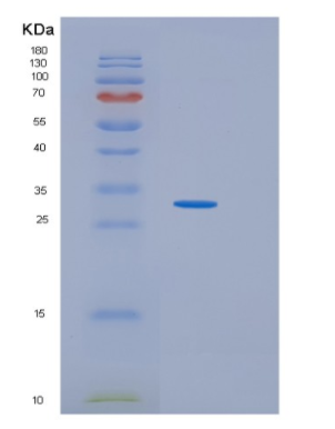 Recombinant Human IDI2 Protein