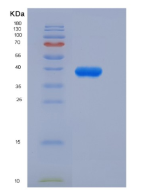 Recombinant Insulin Like Growth Factor 1 (IGF1)