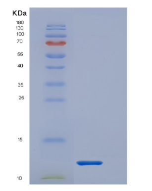 Recombinant Interleukin 1 Receptor Type I (IL1R1)