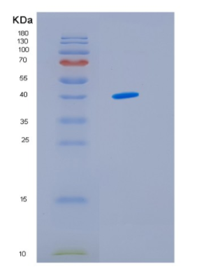 Recombinant Human IDH3G Protein