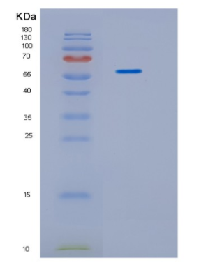 Recombinant Human IDS Protein