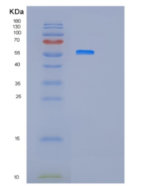 Recombinant Human IFIT3 Protein