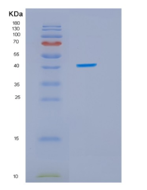 Recombinant Human IDO1 Protein