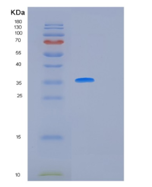 Recombinant Human IL12 Protein