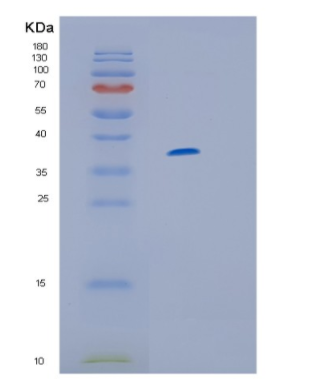 Recombinant Human IL13RA1 Protein