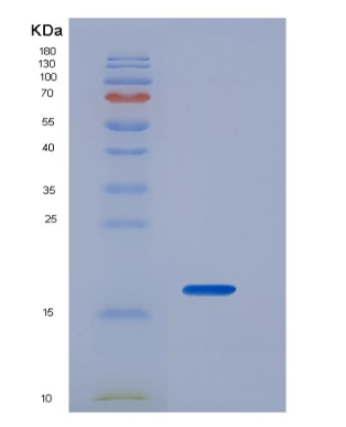 Recombinant Interleukin 2 (IL2)