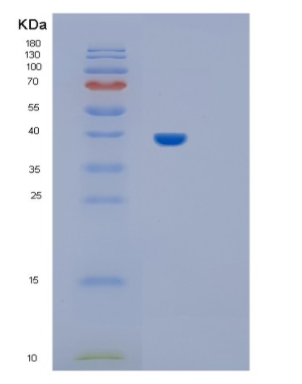 Recombinant Rat IL11ra1 Protein