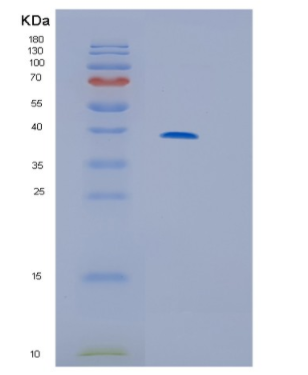 Recombinant Human IL13RA2 Protein