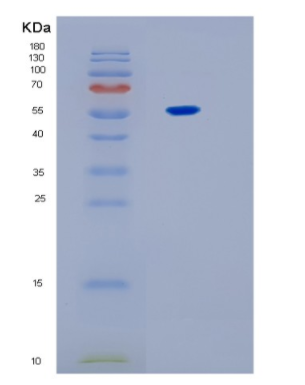 Recombinant Human IL17RB Protein