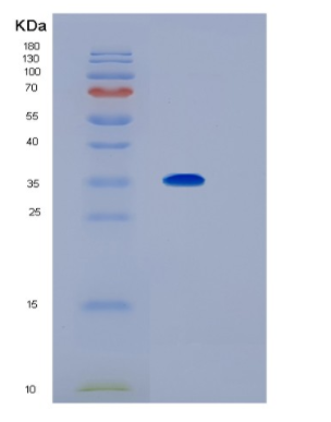 Recombinant Human IL1RL1 Protein