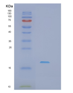 Recombinant Human IFT20 Protein