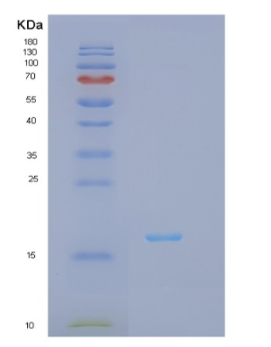 Recombinant Human IFNG Protein