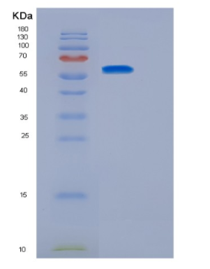 Recombinant Human IL23R Protein
