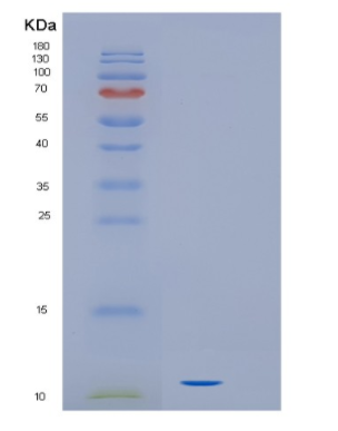 Recombinant Human IL16 Protein