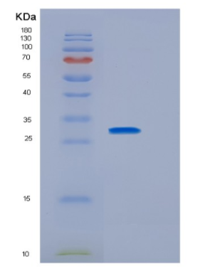 Recombinant Human IL2RG Protein