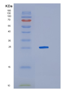 Recombinant Human IL10RA Protein