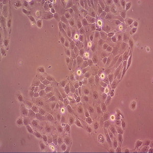 COL0320DM人结肠腺癌细胞