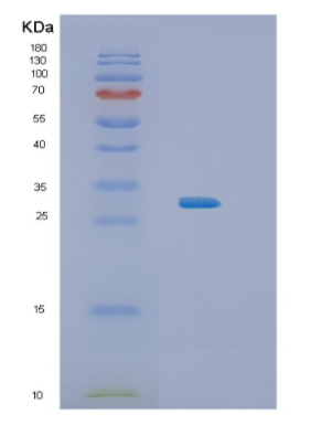 Recombinant Human IL34 Protein