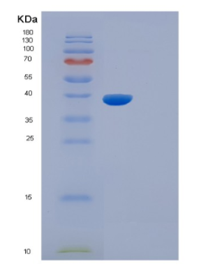 Recombinant Mouse Il5ra Protein