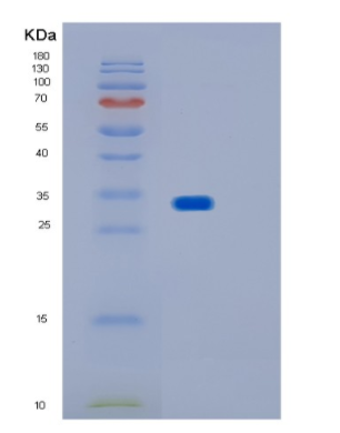 Recombinant Human IMPA1 Protein