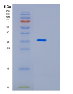 Recombinant Mouse Impad1 Protein