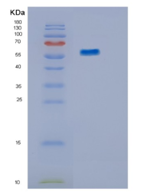 Recombinant Human IMPDH2 Protein