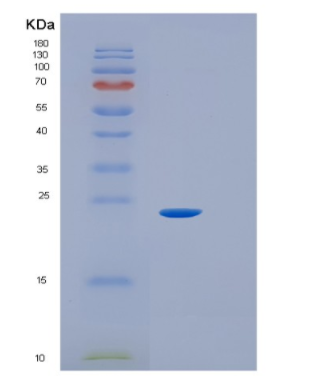 Recombinant Mouse IL6 Protein