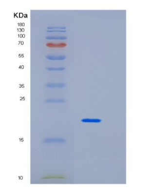 Recombinant Human Interleukin-10 Protein