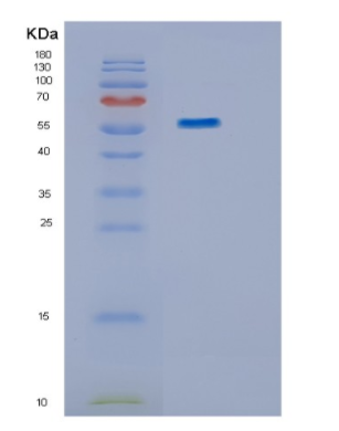 Recombinant Human IMPDH1 Protein