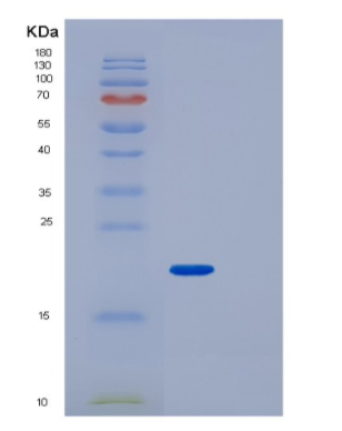 Recombinant Human IPP-1 Protein