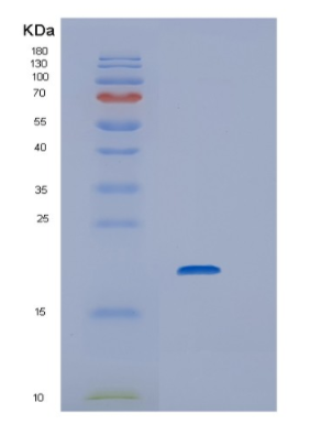 Recombinant Human Interleukin 6 Protein