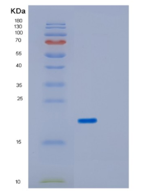 Recombinant Human IRGM Protein