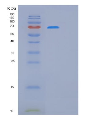 Recombinant Human ITGB1 Protein