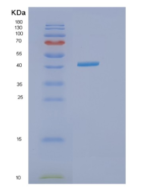 Recombinant Human IVD Protein