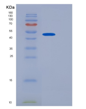 Recombinant Human JMJD6 Protein