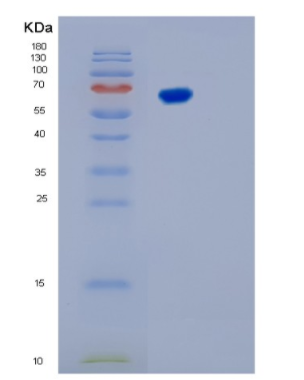 Recombinant Human KARS Protein