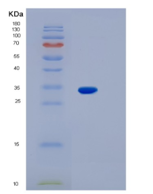 Recombinant Human KCNIP3 Protein