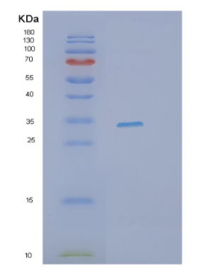 Recombinant Human ITLN1 Protein