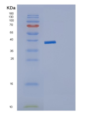 Recombinant Human JMJD7 Protein