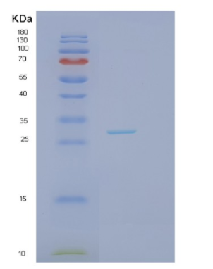 Recombinant Human JAZF1 Protein