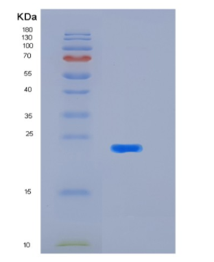 Recombinant Human KIR2DL1(p58 KIR Protein