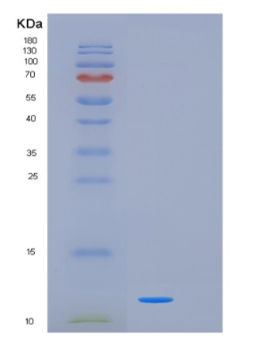 Recombinant Human KISS1 Protein