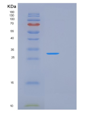 Recombinant Human KLK2 Protein