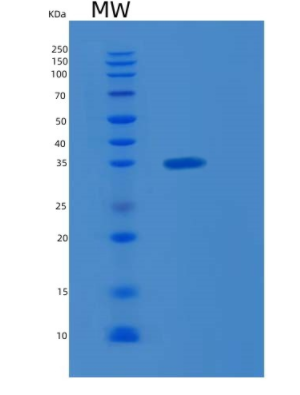 Recombinant Human KLF6 Protein